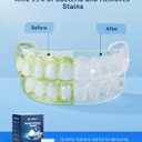 Retainer Cleaner Tablets (120 pcs), Denture Cleaning Tablets for Invisalign, Night Mouth Guard for Aligners, Remove Odors Stains and Plaque, Quick Cleanser, Mint Fresh Flavor, 4 Month Supply (Blue)