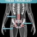 Sacroiliac SI Joint Belt for Women & Men - Adjustable Pelvic Hip Support Brace, Posture Corrector Belt for Sciatica Lower Back Discomfort Pregnancy Support Anterior Pelvic Tilt Correction (L)