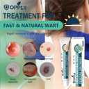 2 x Wart Removal Ointment with 17% Salicylic Acid Extra Strength Wart Remover Cream for Plantar, Common & Flat Warts on Hands & Feet