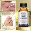 "STAY STOKED" Wart Remover, 15ml Fast-Acting Wart Freeze Off Liquid - The Strongest Wart Remover for Feet, Clinically Proven to Eliminate Stubborn Warts Resistant, Quick-Drying for Daily Use-H5520