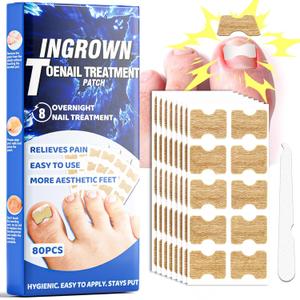 Ingrown Toenail Treatment, 80 Pcs Glue-Free Breathable Corrector Patches, Professional Ingrown Toenail Tools, Not Prone to Falling Off, with File (2 Fl Oz (Pack of 1)) (Blue)