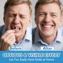 Moldable False Teeth - Veneers Teeth for Women & Men, Silicone Dentures Set for Both Upper and Lower, Temporary Dentures DIY at Home Within Minutes Fix Your Smile