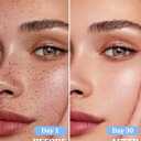 Dark Spot Remover for Face and Body: Dark Spot Corrector Cream, Melasma, Freckle, Sun Spot, Age Spot Remover with Niacinamide and Tranexamic Acid, Natural Formula for All Skin Types - 1.7 Fl Oz