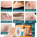 Arme Silicone Scar Tape, 1.6"x480" Silicone Scar Sheets(4 Rolls-12M) Medical Grade Scar Tape for Surgical Scars, Reusable Scar Patches, Professional Scar Removal Strips for C-Section Keloid Tummy Tuck