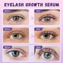 Lash Serum Natural & Vegan Eyelash Growth Serum for Longer, Thicker, Fuller Lashes Nourishing & Conditioning Formula Safe for Sensitive Eyes - 5ml