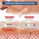 2 x Silicone Scar Tape, (1.6X116 inches), Silicone Scar Tape for Scar Removal Treatment, Suitable for Caesarean Section, Scars, Burns, Acne, Surgical Scars