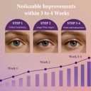 3 x Lash Serum for Eyelash Growth  Eyelash Enhancing Serum for Longer, Fuller, Healthier Looking Lashes  Gentle Cosmetics Formula 5mL (0.17FL OZ)