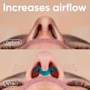 Brison Nasal Dilators for Breathing and Sleeping - 2 Pack Anti Snoring Nose Vents Opener for Better Breathing Sleeping and Activity Improves Airflow - 2pcs Soft-Hard
