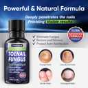 Tobcharm Toenail Fungus Treatment : Nail Fungus Treatment Extra Strength with Tea Tree Oil - Fast Acting Fungal Nail Solution with Undecylenic Acid for Toenails and Fingernails (2pack, 1fl oz each)