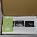 KeaBabies Baby Sonogram Picture Frames - Trio Ultrasound Picture Frame, First Time Mom Gift, Cute Pregnancy Reveal Photo Frame, Baby Gender Reveal & Mother's Day, Newborn Nursery Decor (Alpine White)