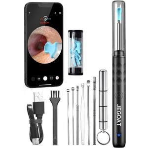 Ear Wax Removal Tool Camera, Ear Cleaner with Camera, 1296P HD Ear Scope, 6 LED Lights and 12 Ear Picks, Earwax Removal with Otoscope, Jet Black