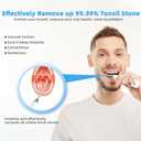 Voraiya Electric Tonsil Stone Remover, Tonsil Stone Vacuum, 10 in 1 Electronic Tonsil Stone Removal Kit, 5 Modes Cleaner for Tonsil