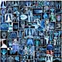 110PCS Radiology X Ray Stickers, Radiology Party Favors Birthday Party Decorations Vinyl Waterproof Stickers for Water Bottle Laptop Luggage Xray Tech