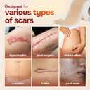 2 x AllSett Health Silicone Sheets for Scars, Post Surgery, Tummy Tuck, C-Section Recovery, Keloid Bump Removal, Stretch Marks Removal (6 Inch x 1.6 Inch), Pack of 6