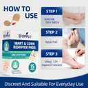 Wart Remover Pads