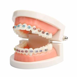 Dental Orthodontic Teeth Model with Braces Denture Mouth Model for Dentistry