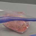 Momcozy Larger Breast Therapy Packs, Hot and Cold Breast Pads with 2 Soft Covers, Breastfeeding Essentials2 PackPink