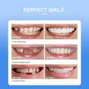 Snap On Veneers Teeth for Men and Women - Moldable False Teeth and Dentures Replacement Kit for Missing Teeth, with Teeth Grinding Guard, Best Whitening Strips and Fake Braces for Bad Teeth