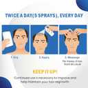 Minoxidil for Men and Women Hair Growth: 5% Minoxidil Topical Spray Hair Regrowth Treatment Stop Hair Thinning and Hair Loss For Stronger Thicker Longer Hair 60ml 2 Pack