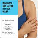 AmLactin Intensive Healing - Therapeutic Body Cream for Extremely Dry Skin - No-Scrub Exfoliator and Body Moisturizer Cream with 15% Lactic Acid AHA and Ceramides, 12 oz