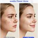LED Light Therapy Machine FDA Cleared Red,Face Mask Skin Care Photon Device