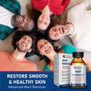 SKAYAH Wart Remover Freeze Off - Professional Strength Wart Remover Liquid - 5% Salicylic Acid Fast-Acting Treatment for Plantar Wart,Flat Wart, Corn and Callus Remover, 15ml (0.5 fl oz)-H236