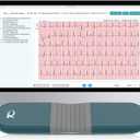 Portable Heart Rate Monitor with Chest Strap,Easy to Wear, 72 Hours Battery Life