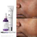 La Roche-Posay Mela B3 Serum, Dark Spot Corrector With Anti-Aging Melasyl + 10% Niacinamide, Discoloration Correcting Serum for Sun Spots, Age Spots & Post-Acne Marks