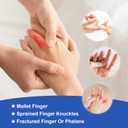 Promifun Finger Braces, Trigger Finger Splints for Straightening, Mallet Finger and Broken Finger, Finger Straighteners Provide Support and Relieve Pain - Khaki (Beige)