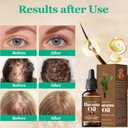 Organic Batana Oil with Rosemary for Hair Growth - Deep Nourishes All Hair Types, Reduces Hair Loss, 30ml