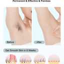 IPL Laser Hair Removal for Women and Men Permanent At-Home Lazer Facial Hair Epilator 999,999 Flashes Painless Hair Remover on Armpits Back Legs Arms Face Bikini Line