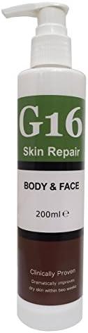 G16 Skin Repair Dry Skin & Ichthyosis Treatment Cream - Outstanding Results in 2 Weeks