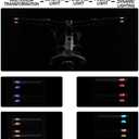 Bicycle Handlebar Grips with LED Lights  USB-C Rechargeable, Universal 22mm Fit, Touch Control & 12 Light Modes for Night Riding | Shock-Absorbing Silicone Design