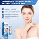 Fast Natural WART Removal Ointment Active Ingredient Salicylic Acid