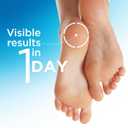 Flexitol Heel Balm, Cracked Heel Cream & Foot Balm, Intensive Hydration for Dry, Rough Feet & Heels, Urea-Based Moisturizing Cream, 4 oz Tube