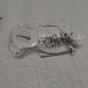 Ultra-Slim Bidet Attachment, Posterior&Feminine Wash-(Retractable Dual Nozzles), Non-Electric Bidet Attachment for Toilet Seat, Adjustable Fresh Cold Water Pressure, Stainless Steel Inlet (White)