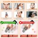 2026 Pore Vacuum, USB Rechargeable Blackhead Remover Vacuum,3 Levels Adjustable Pore Vacuum Blackhead Remover, with 5 Suction Power,6 Probes,Face Vacuum Pore Cleanser for Women & Men-White