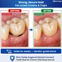 Zinc Oxide Eugenol Dental Cement Kit – Instant Tooth Repair, Cap, Crown & Bridge Filling | Ultra Strong & Pulp-Soothing Formula | Long Lasting - Easy Mix-and-Use Dental Adhesive for DIY, Home & Clinic