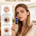 USB Rechargeable Skin Tag Remover Pen - 9-Speed Professional Mole Wart Removal Tool, LCD Display & Safety Lock, Painless Spot Remover for Face Body
