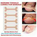 Ingrown Toenail Corrector Set with Correction Strips, Professional Ingrown Toenail Removal Kit, Toenail Correction Strips & Ingrown Toenails Pedicure Tool Set for Home Pedicure Care