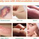 3 x Extra Thin Hydrocolloid Bandages 10 Pack 4" x 4" Large Wound Care Dressing, Self Adhesive Big Waterproof Hydrogel Patch Bandaids Healing for Burn Blister Bedsore Acne Care