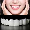 2 Pairs Professional Smile Improver - Recreate Confident Smiles in Minutes (1)
