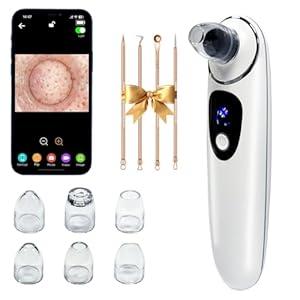 2026 Pore Vacuum with Camerafor, USB Rechargeable Blackhead Remover Vacuum, 3 Levels Adjustable Pore Vacuum Blackhead Remover, 6 Suction Heads, Face Vacuum Pore Cleanser for Women & Men-White