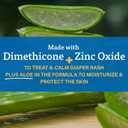 A+D Zinc Oxide Diaper Rash Treatment Cream, Dimethicone 1%, Zinc Oxide 10%, Easy Spreading Baby Rash Cream, 4 Ounce Tube