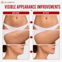 3-in-1 Body Sculpting Machine, Cellulite Massage Tool, Body Sculptor, Helps Smooth Cellulite & Stretch Marks Appearance, Relieves Muscle Tension and Tightens Skin, White