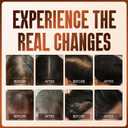 Ginger & He Shou Wu Hair Growth Oil Spray - Infused with Biotin & Castor Oil to Reduce Breakage, Prevent Shedding & Boost Shine - For All Hair Types - 50ml