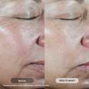 Revision Skincare C+ Correcting Complex 30% Vitamin C Serum for Face Anti-Aging Treatment to Brighten Skin, Reduce Fine Lines, Wrinkles & Dark Spots, Firming & Safe for Sensitive Skin