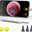 Anykit Digital Otoscope with Gyroscope, HD Ultra Clear View Ear Camera with Ear Wax Removal Tools, Video Ear Scope Otoscope with Light, Compatible with Android, iPhone 15 (Silver)