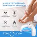 New Nail Fungus Device for Multiple Toenails & fingernails, Toenail Fungus Device, Nail Repair Solution for Damaged and Discolored Nails, Suitable for Home Use White 2026