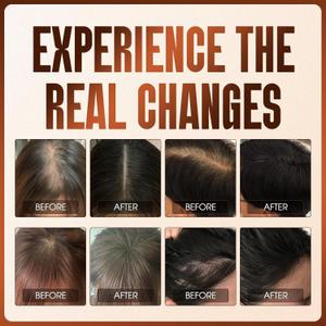 Ginger & He Shou Wu Hair Growth Oil Spray - Infused with Biotin & Castor Oil to Reduce Breakage, Prevent Shedding & Boost Shine - For All Hair Types - 50ml